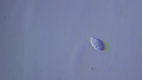 Feeding ciliate under Oblique light Microscope Video stock 80368859