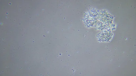 Feeding ciliate under Phase contrast Microscope 스톡 동영상 80361231