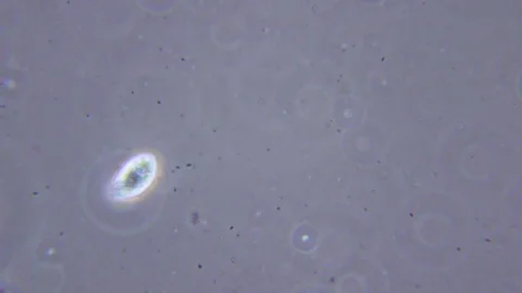 Feeding ciliate under Phase contrast Microscope 스톡 동영상 80368084