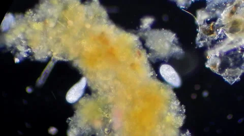 Feeding infusoria under microscope Видео 33661714