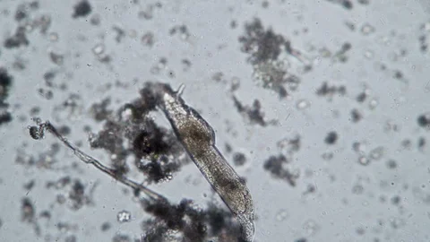 Feeding a large rotifer in fresh water m... | Stock Video | Pond5