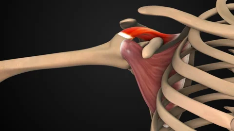 Feeling Sharp Shoulder Pain Radiating to Arm Bone Stock Footage 320926467