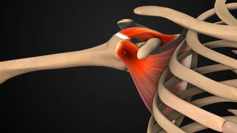 Feeling Sharp Shoulder Pain Radiating to Arm Bone Illustration