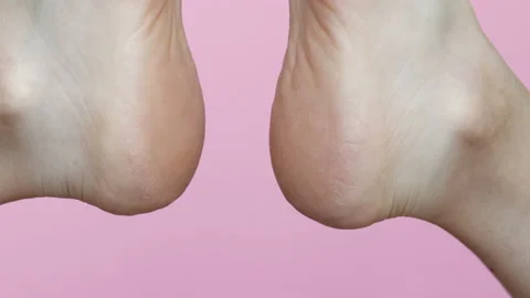 Feet raised up on light pink background. dry skin of heels. Stock Footage 199575464