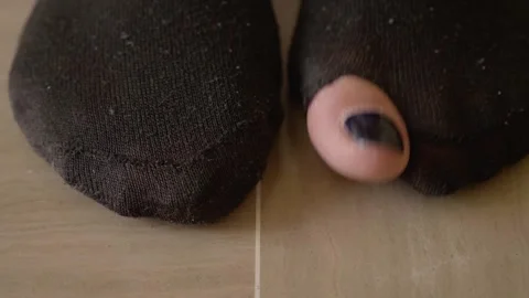 Feet with socks: one is torn with a toe sticking out, metaphor of economic crisi Stock Footage 289001854