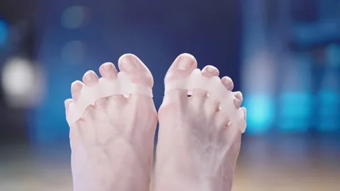 Feet with soft silicone toe corrector fixing hallux valgus 4K Stock Footage 170117202