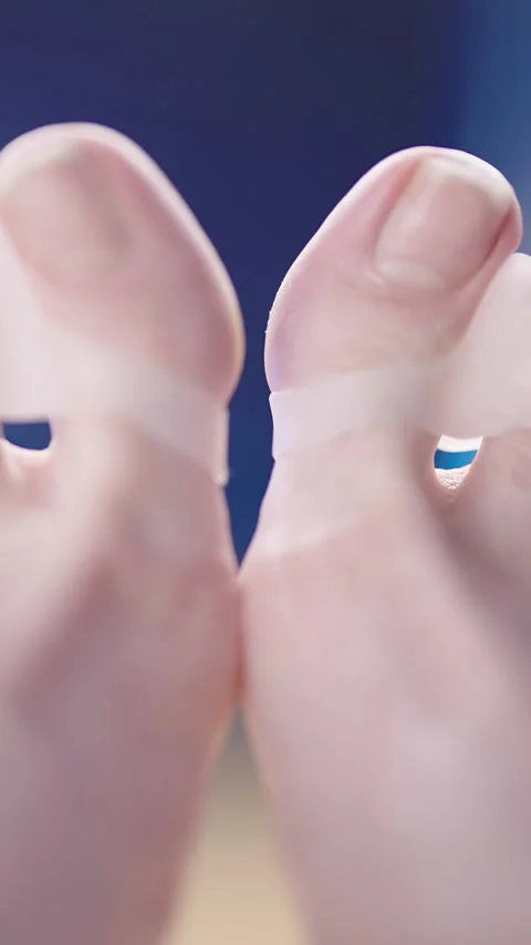Feet with soft silicone toe corrector fixing hallux valgus Video stock 324961032