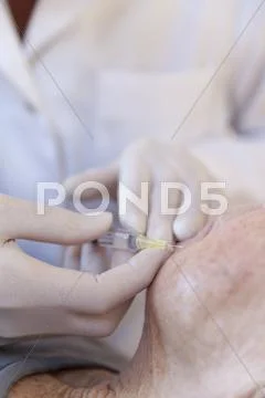 Female Alternative Practitioner Giving Senior Woman Injection Acupuncture