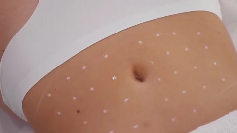 Female belly with marks Stock Footage 147188879