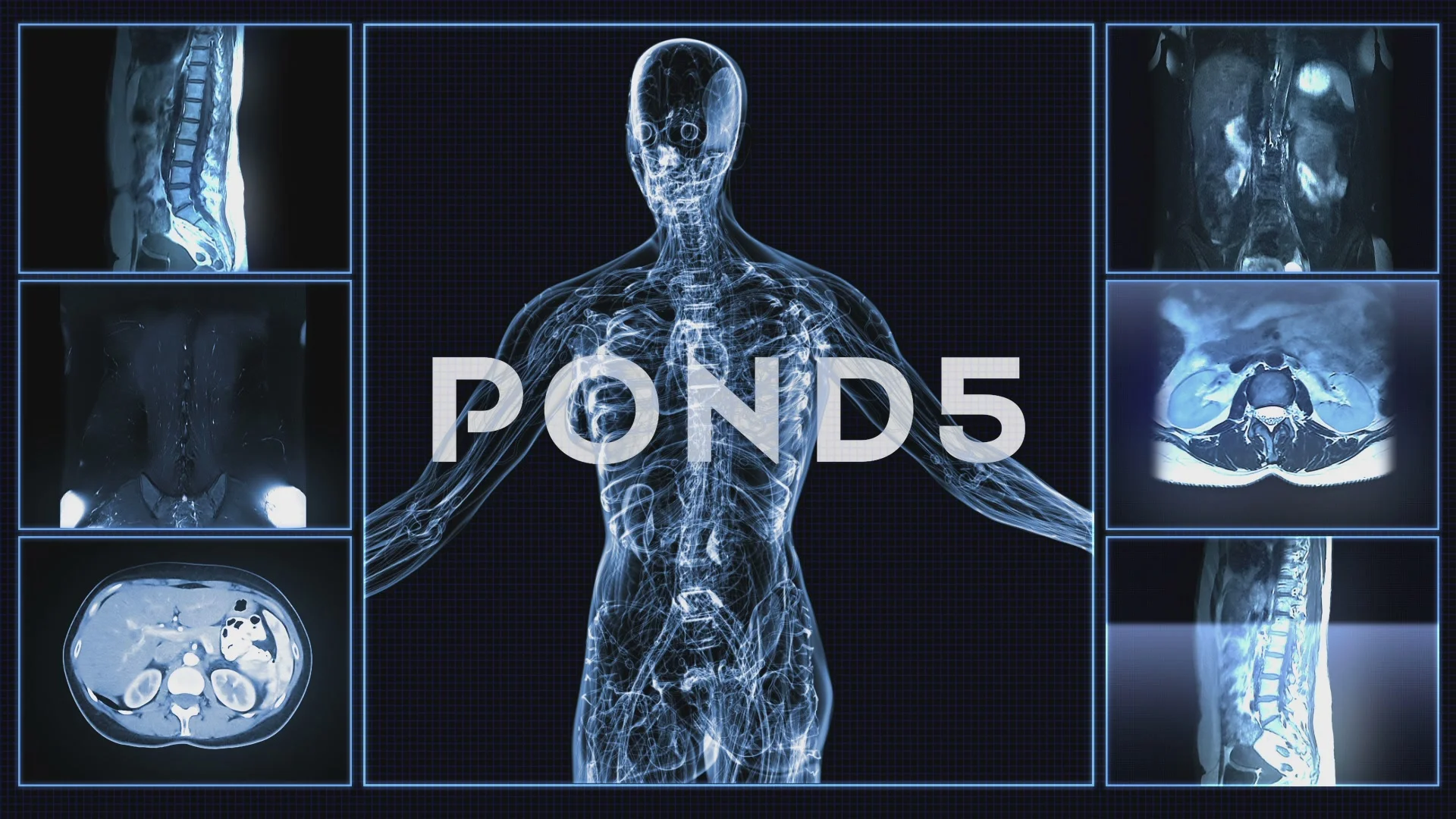 X Ray Body Scanner Girl