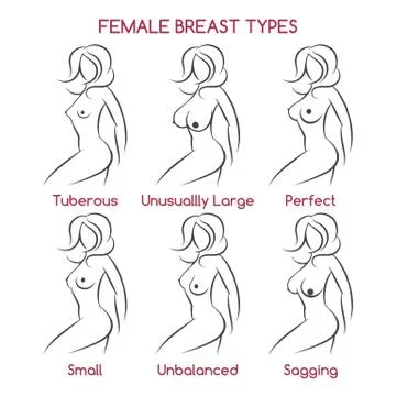 Female Breast Types Stock Illustration