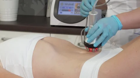Female client undergoing rejuvenating rf-lifting treatment on her abdomen Stock Footage 311982731