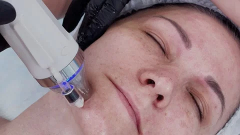 Female cosmetologist performs RF lifting procedure on a client 库存影片 337737977