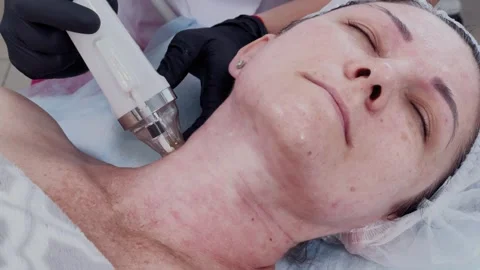 Female cosmetologist performs RF lifting procedure on a client Stock Footage 337738106