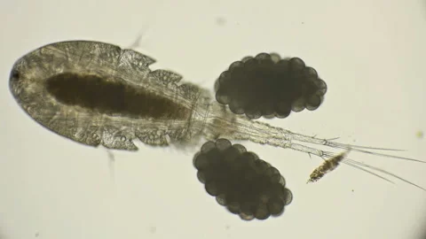 Female Cyclops with egg sacks under microscope Vidéo 89164536