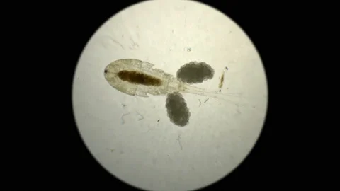 Female Cyclops with egg sacks under microscope Vidéo 89166280