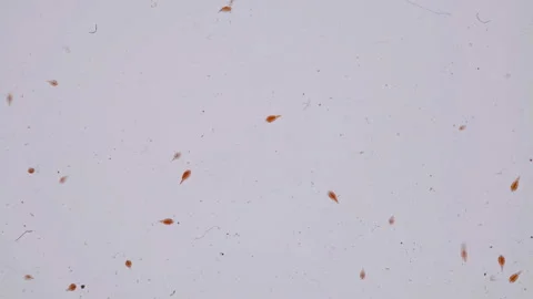 Female Cyclops with egg sacks under microscope Vidéo 89578154