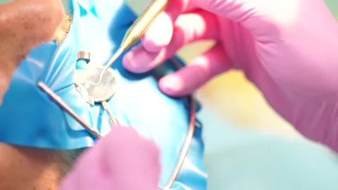 Female dentist checking up patient teeth Video stock 137401985