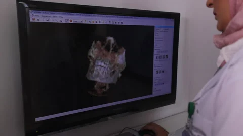 Female dentist testing teeth of the patient 스톡 동영상 146164220