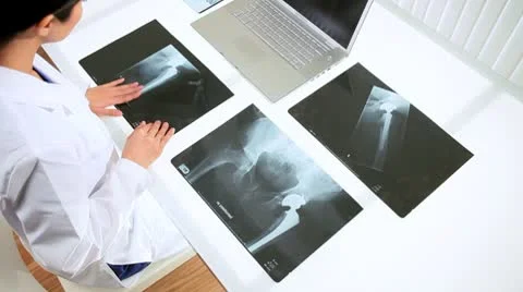 Female Doctor in Radiology Examining X-Rays Stock Footage