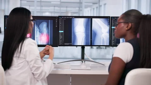 Female Doctor Studying Knee Bone X-ray Stock Footage 334924098