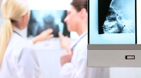 Female Doctors Inspecting X-Ray Results Stock Footage