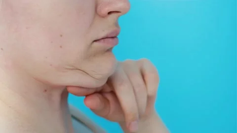 Female face with double chin close-up on blue background, side view. Stock Footage 172094848