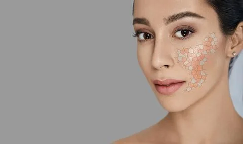 Female face with skin problems, concept. Dry and irritated skin on woman's fa Foto stock