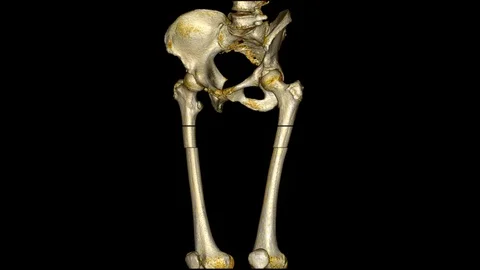Female Hip, Skeleton 스톡 동영상 86213436