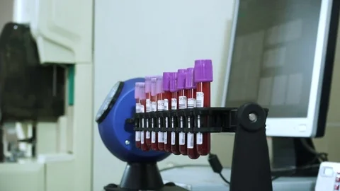 Female laboratory assistant analyzing samples of blood at modern equipment. HD Видео 72390064