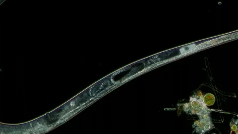 Female Nematode With Developing Embryo at 10x Under Darkfield Microscopy Stock Footage 336944490