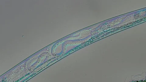 Female Nematode With Developing Embryo at 20x Under Nomarski DIC Stock Footage 336944497