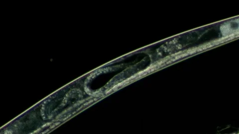 Female Nematode With Developing Embryo at 20x Under Darkfield Microscopy Stock Footage 336944518