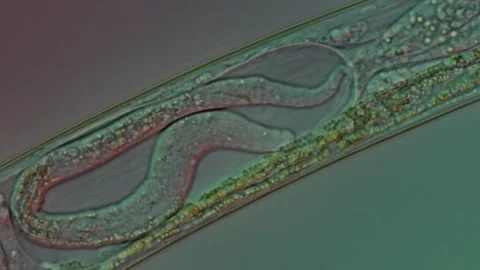 Female Nematode With Developing Embryo at 50x Under Nomarski DIC Stock Footage 336944526