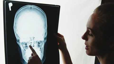 Female orthopedist explaining and analyzing skull xray very serious, close up Stock Footage 178845064