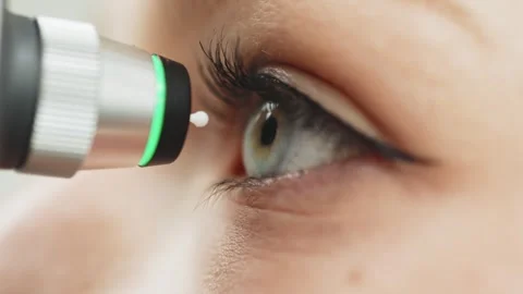 Female patient undergoing glaucoma screening with handheld device, close-up view Stock Footage 337285848