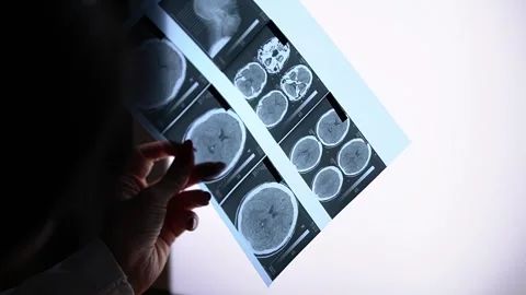 Female radiologist.x-ray. Studies x-ray. Stock Footage 290170153