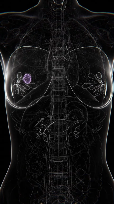 Female Right Side Chest X-ray Vertical Video | Cancer Indication Right side Stock Footage 301072204