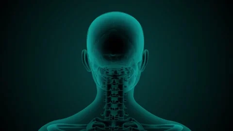 Female Skull Xray Stock Footage 276964138