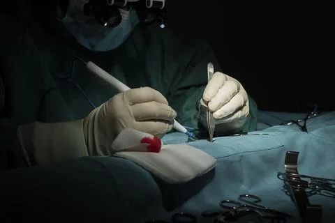 Female surgeon performs a micro-surgery operation on one arm. Stock Photos