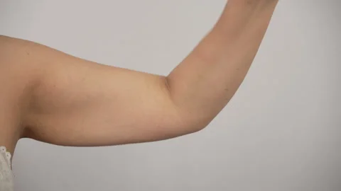Female Upper Arm Close Up Flexing to Show Loose Skin and Flab Видео 345172153