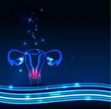 Female uterus problems Illustrazione stock