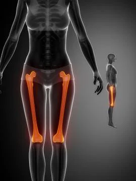 FEMUR black x--ray bone scan 스톡 일러스트