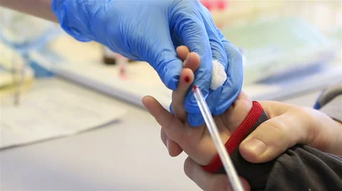 Fence blood test in child Stock Footage 60388206
