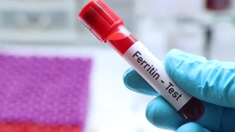 ferritin test to look for abnormalities ... | Stock Video | Pond5