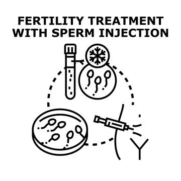 Fertility treatment injecting sperm for conception Stock Illustration