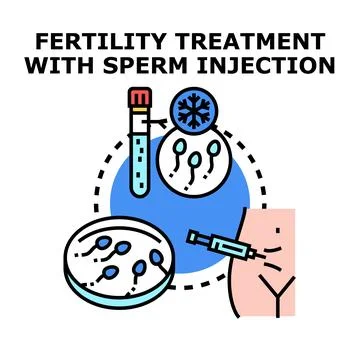 Fertility treatment injecting sperm for conception Stock Illustration