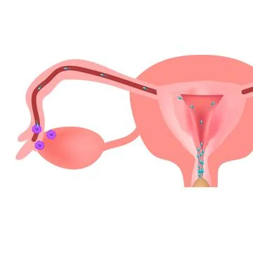 Fertilization of an egg with sperm. Ejaculation into the genital tract. Vector Stock Illustration