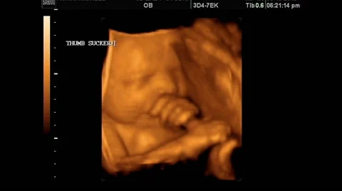 Fetal ultrasound baby sucking thumb Stock Footage