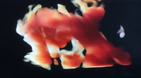 Fetus 3D 5 months Stock-Footage 43084126